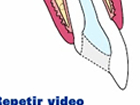 Endodoncia
